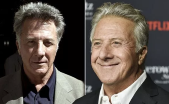 Dustin Hoffman Battles and Triumphs Over Cancer